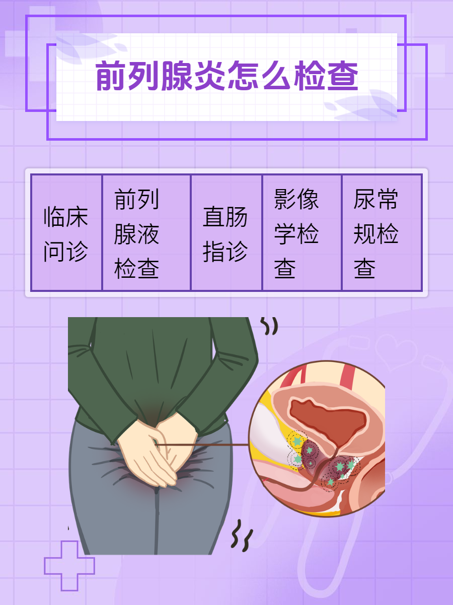 这些检查你需要知道  前列腺炎大家都听说过吧,这种疾病发作的比较