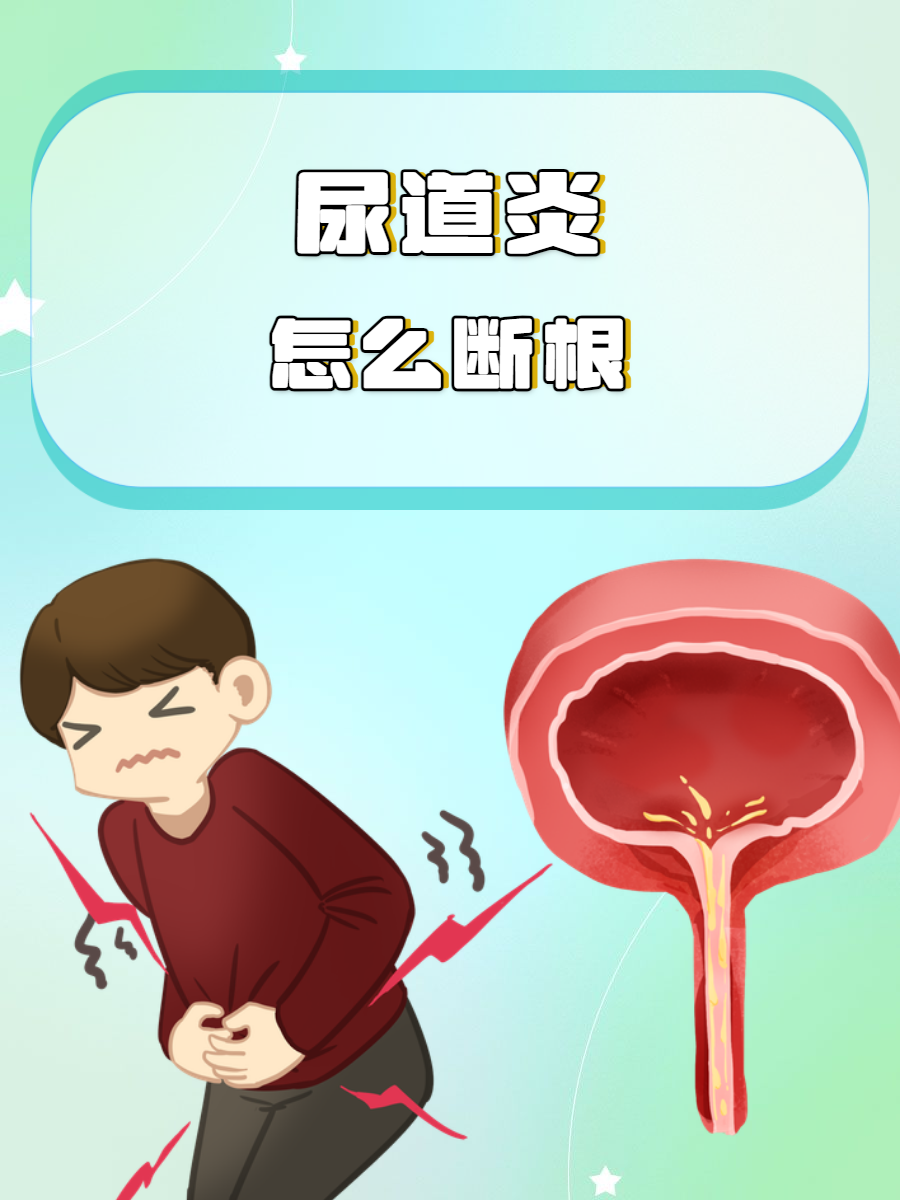 方法解析  尿道炎往往容易频繁发作,出现尿频,尿急,尿痛这些症状,严重