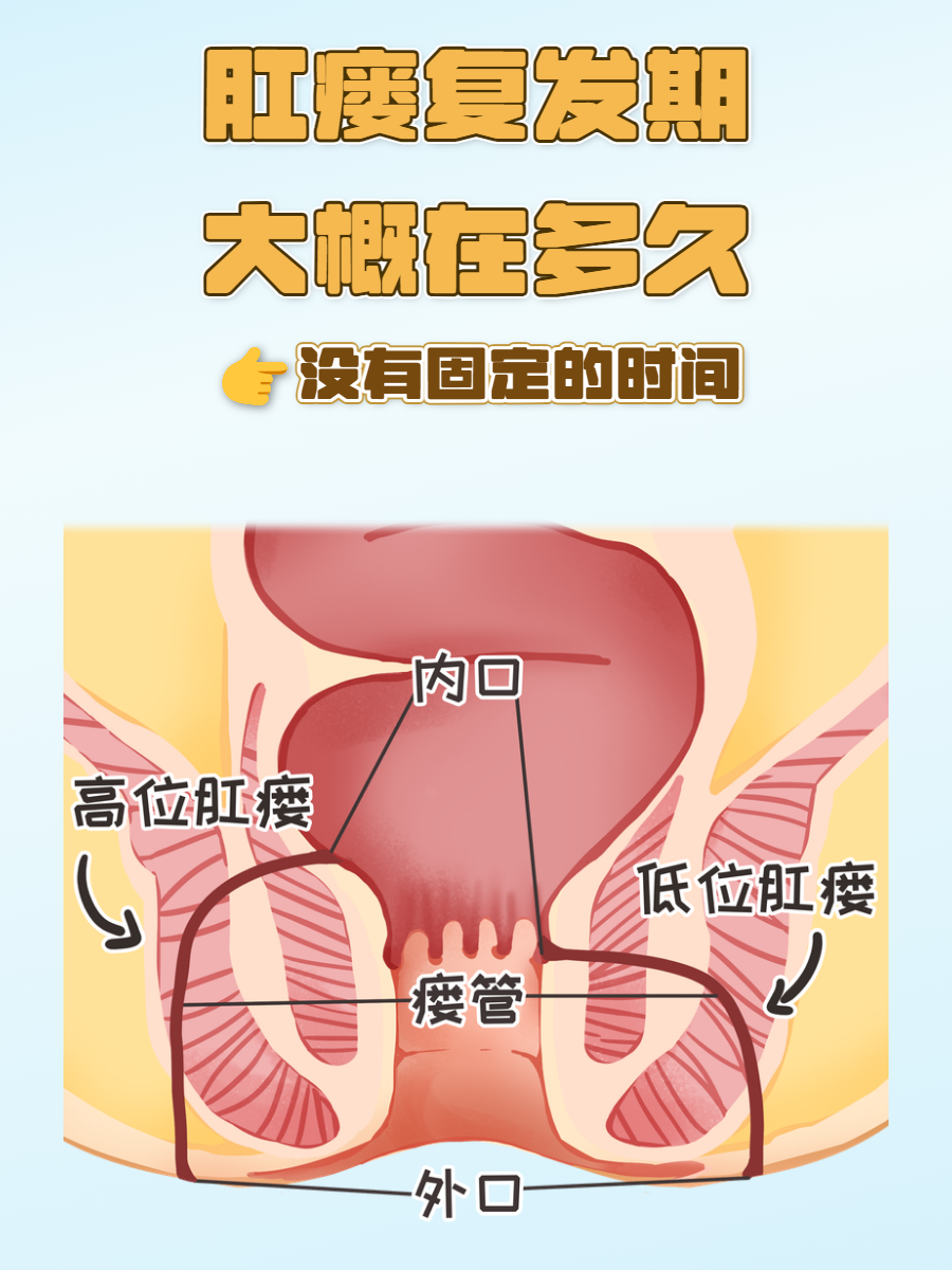 肛瘘瘘管位置图片