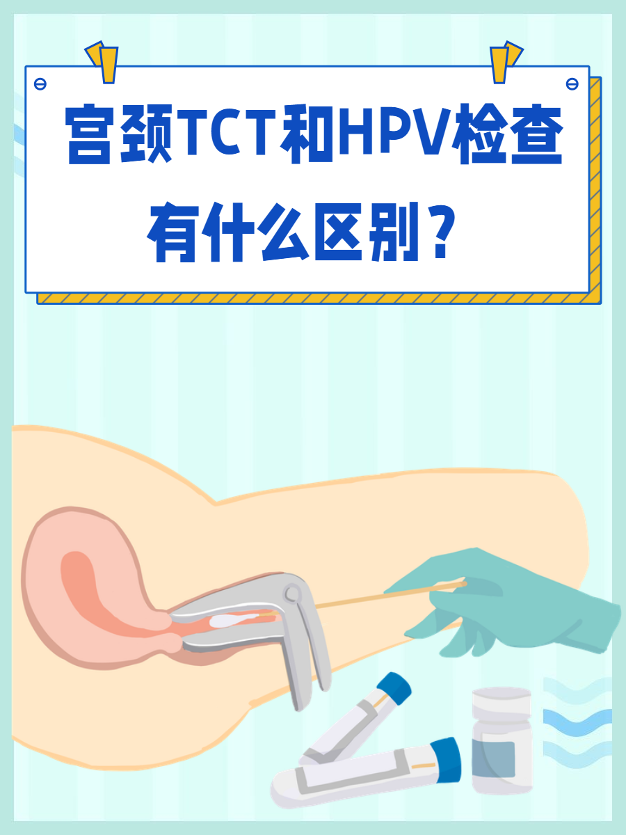 TCT检查