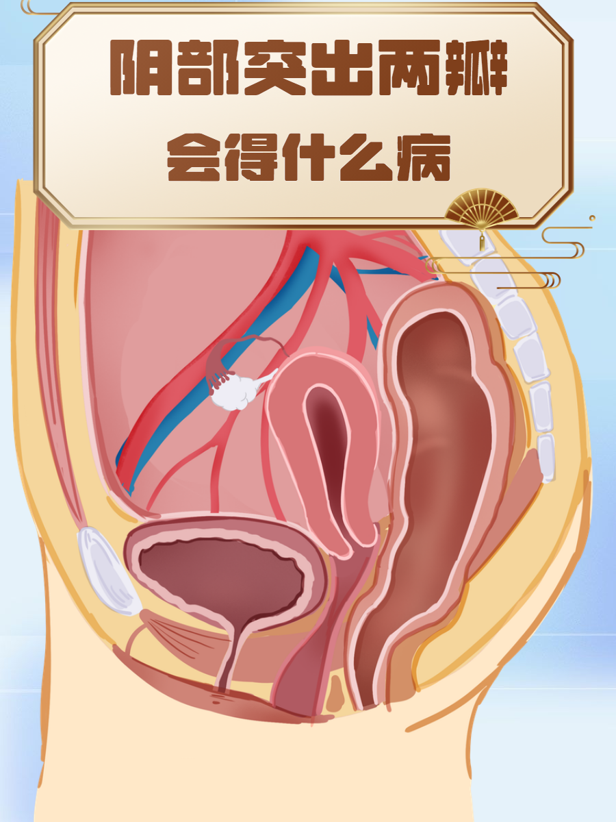阴部异常时,一般都会出现一些可大可小的问题