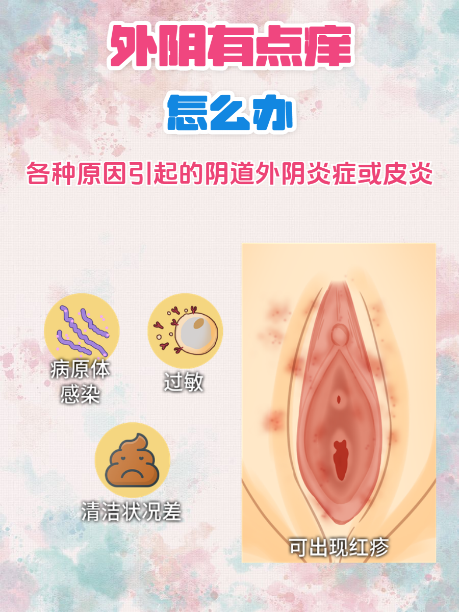 外阴有点痒怎么办?