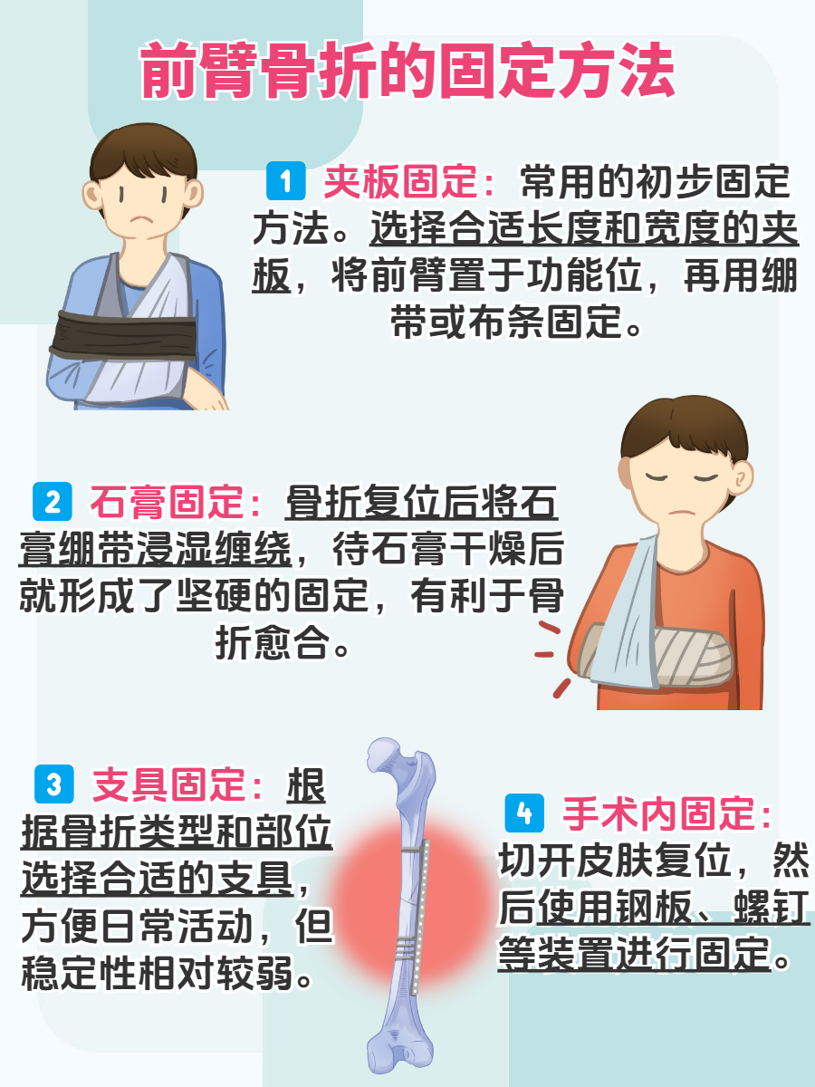 前臂骨折?这些固定方法助你快速康复!
