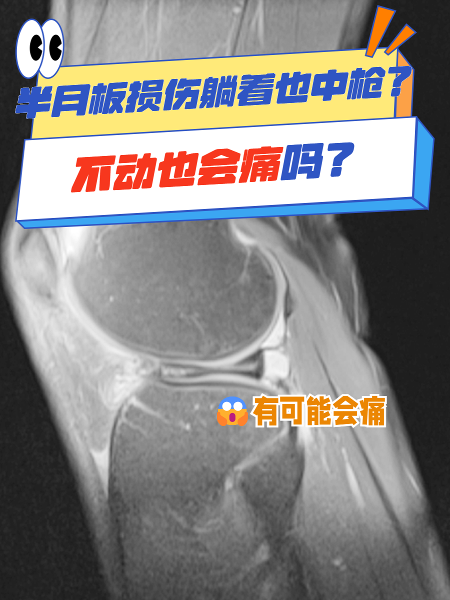 是什么意思内外侧半月板后角损伤半月板撕裂内侧膝盖半月板撕裂磁共振