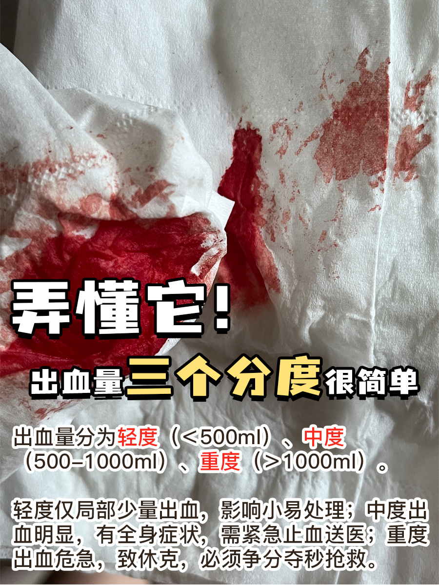 出血量三个分度很简单