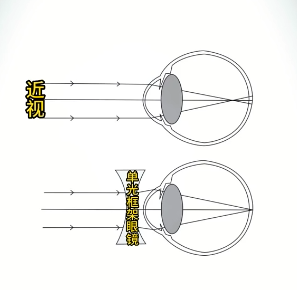 一个是单光的框架眼镜