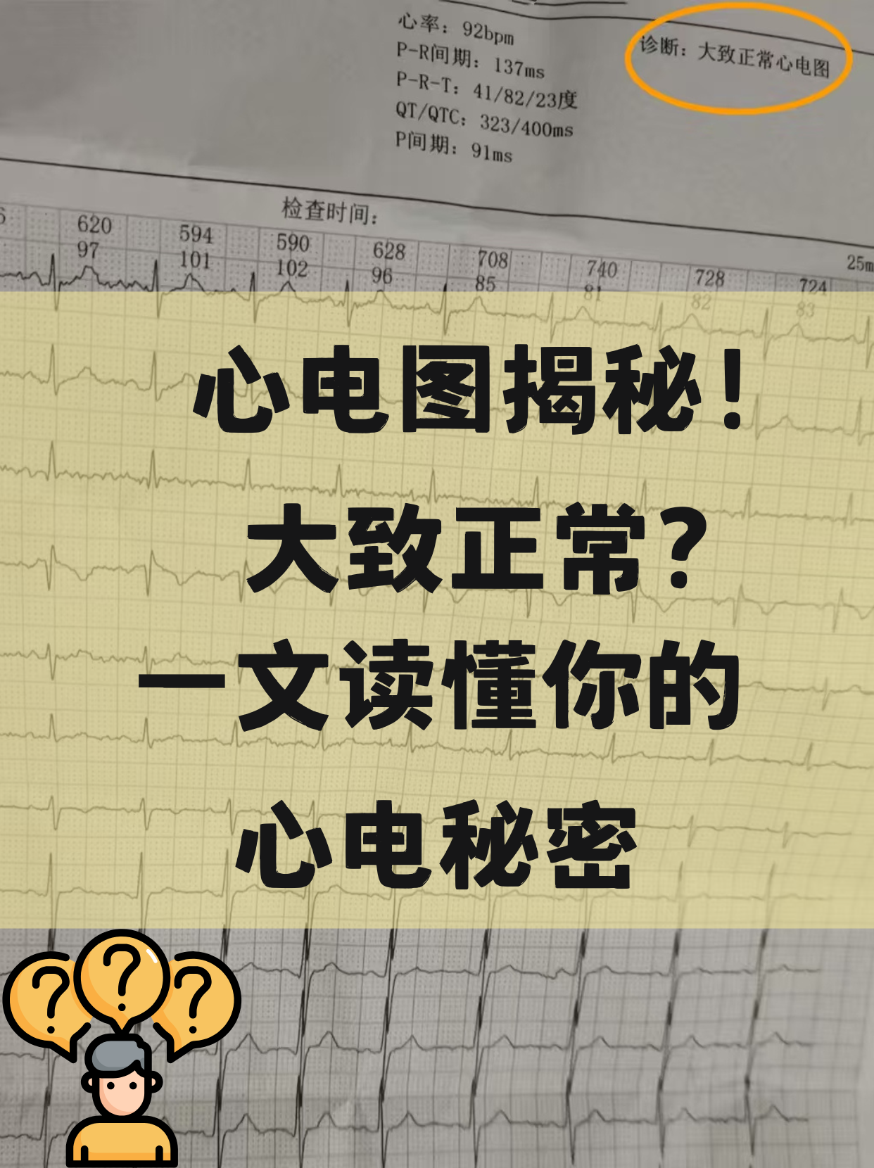 一文读懂你的心电秘密 去医院做心电图检查,拿到报告看到"心电图大致