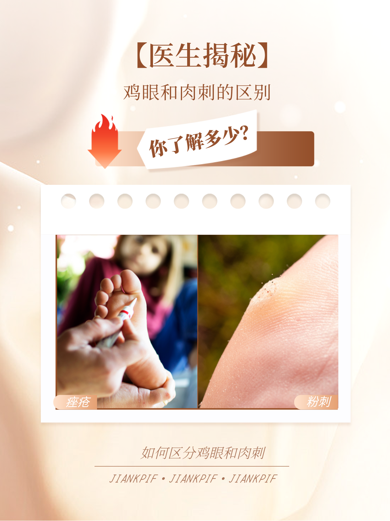 今天咱们来聊聊一个既常见又容易被混淆的小问题——跖疣和鸡眼究竟有