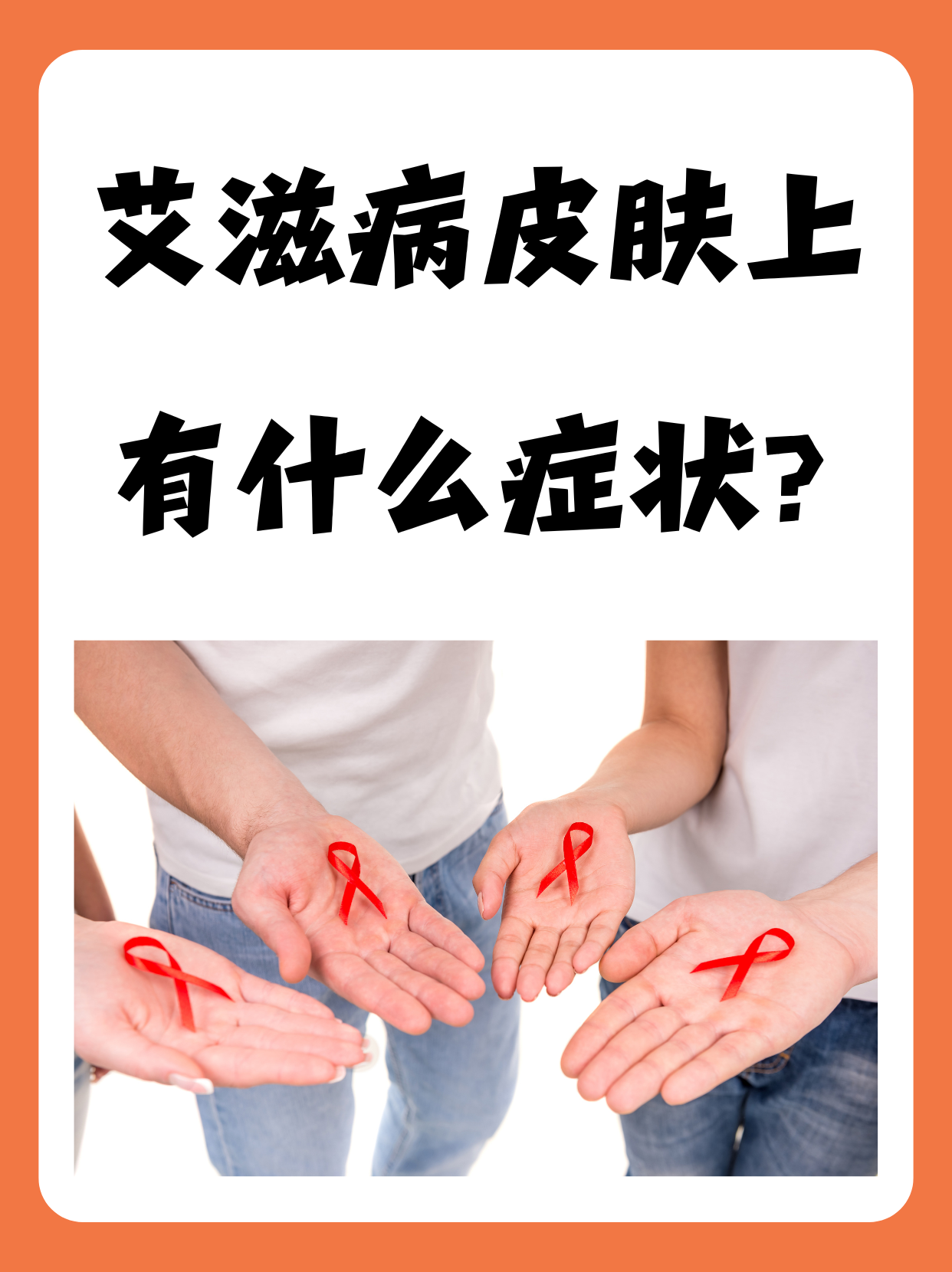 艾滋病为什么那么可怕百科在线 艾滋病为什么那么可怕百科在线