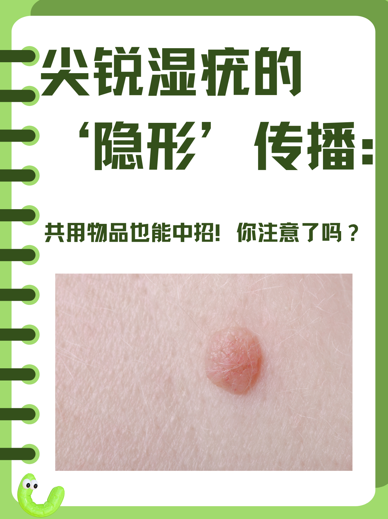 尖锐疣体变黑是为什么引起的百科在线 尖锐疣体变黑是为什么引起的百科在线