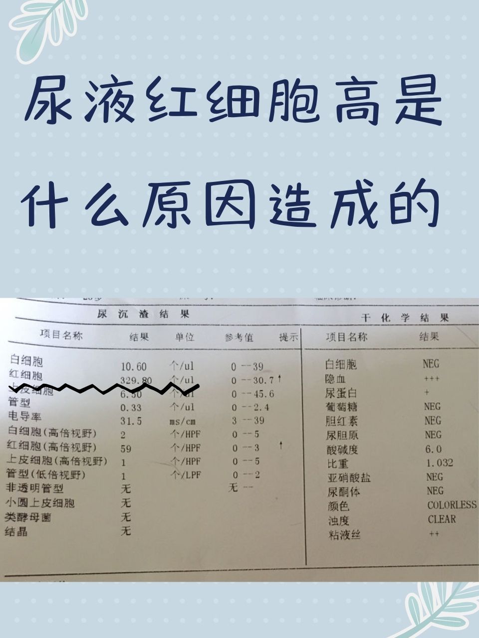 尿沉渣红细胞计数图片