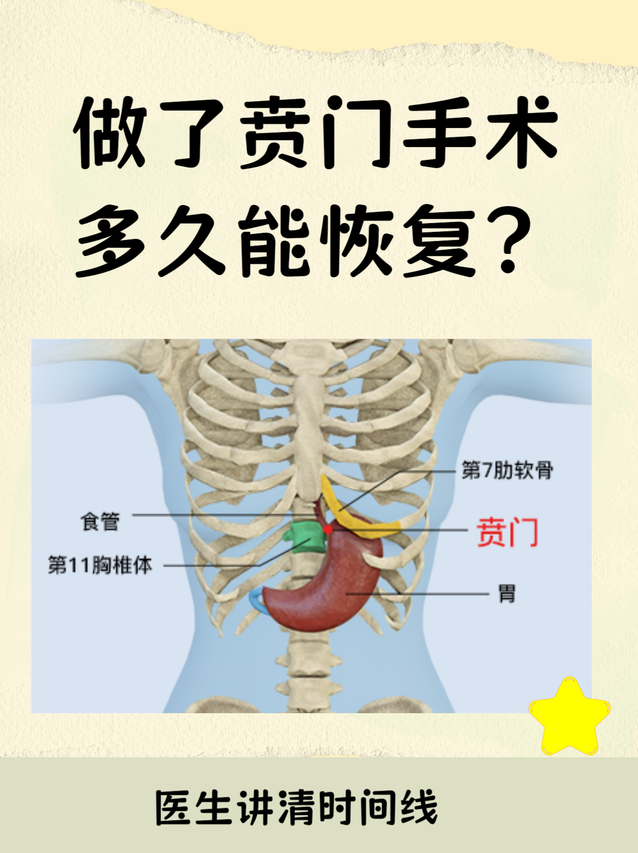 贲门手术是针对食管与胃连接部位