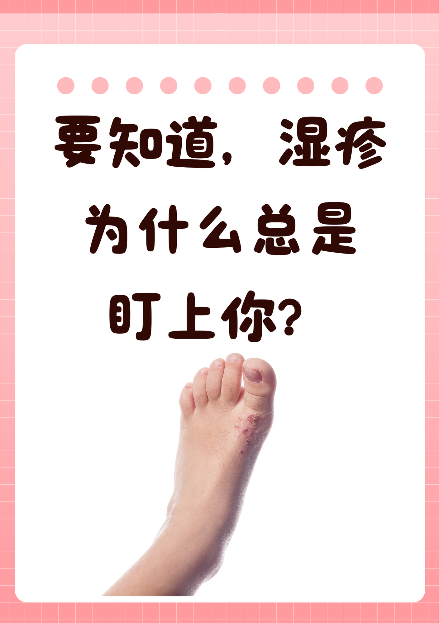 为什么得湿疹 为什么得湿疹