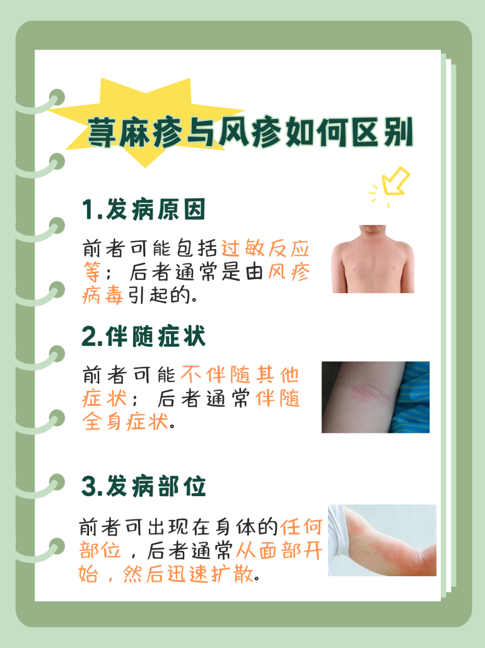荨麻疹与风疹有什么不一样,如何区别?
