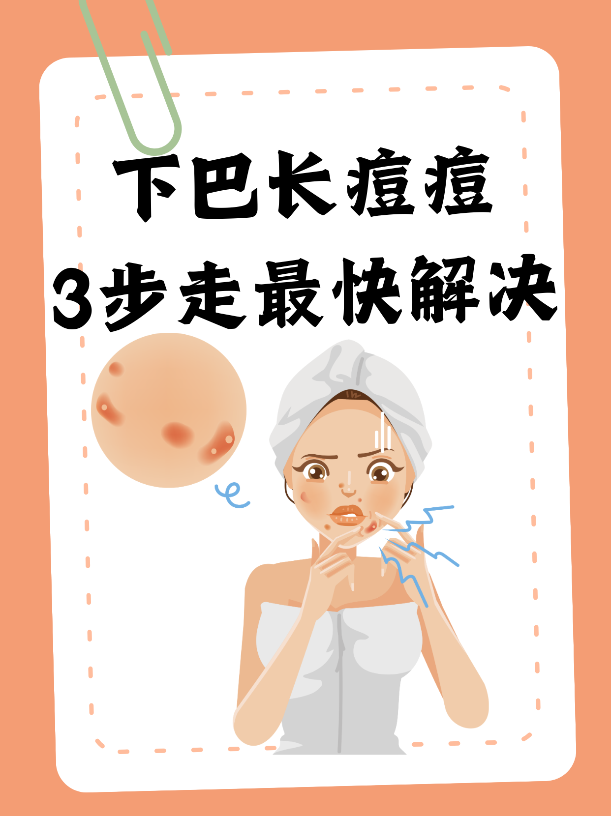 第一步:正确清洁 下巴痘痘往往与油脂分泌过多,毛孔堵塞有关