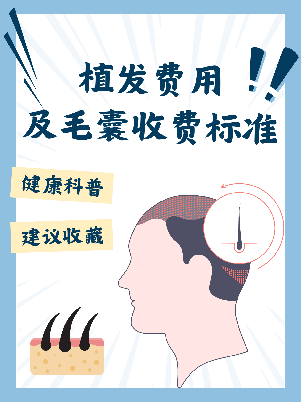 植发要多少钱,一个毛囊的收费标准是什么?