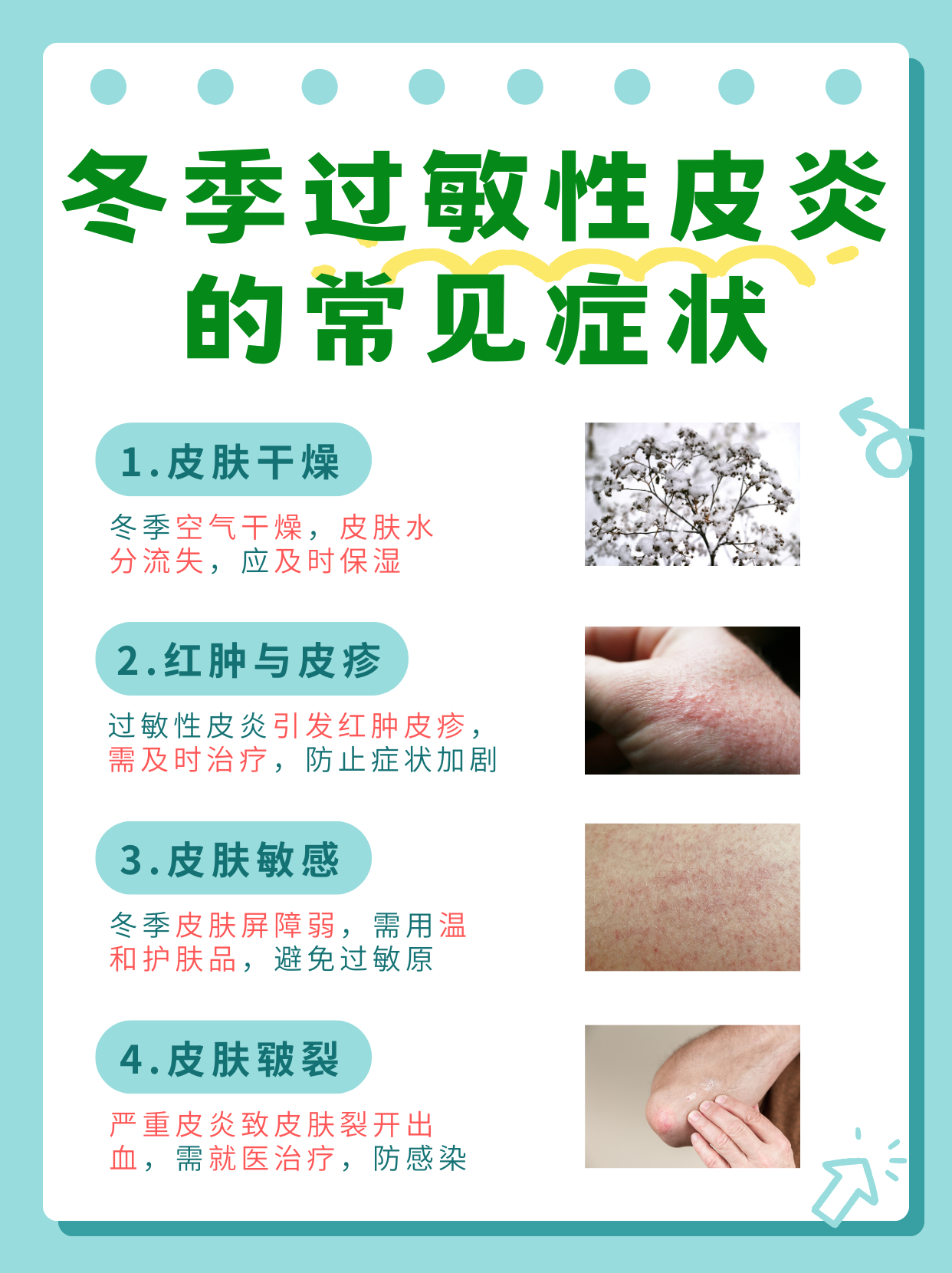 冬季过敏性皮炎,也称为乏脂性皮炎,是一种在冬季常见的皮肤问题