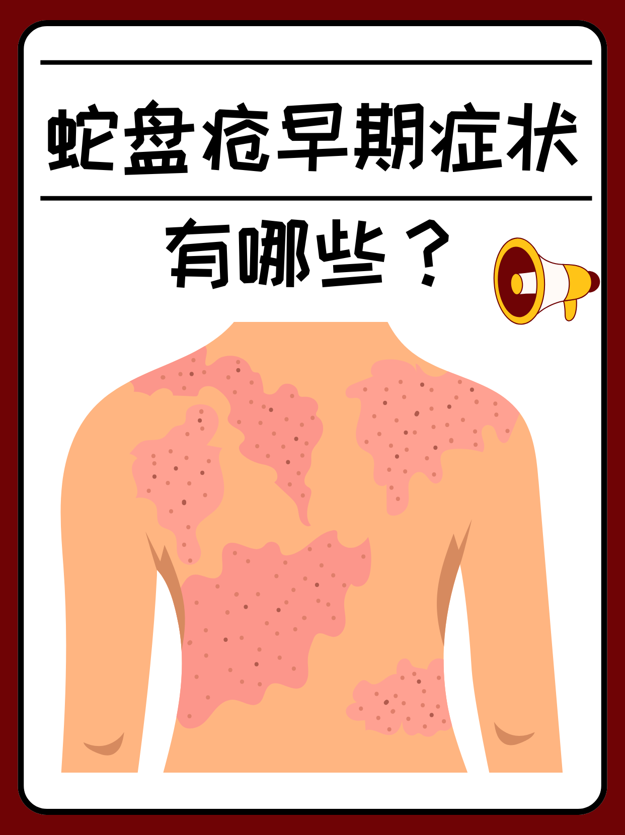 蛇盘疮早期症状有哪些?