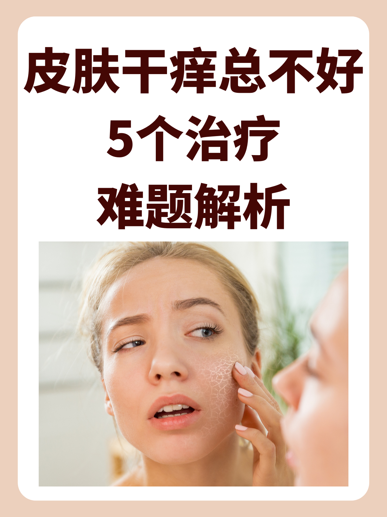 老中医排毒止痒第3周