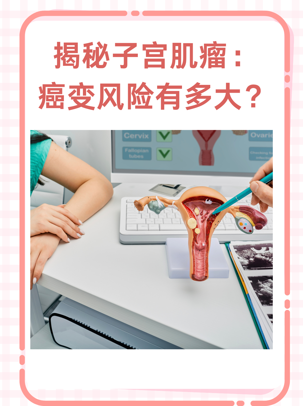 为什么会得子宫肌瘤