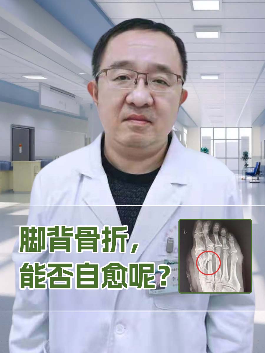 在日常生活中,脚背骨折是一种相对常见的损伤,通常发生在运动事故或