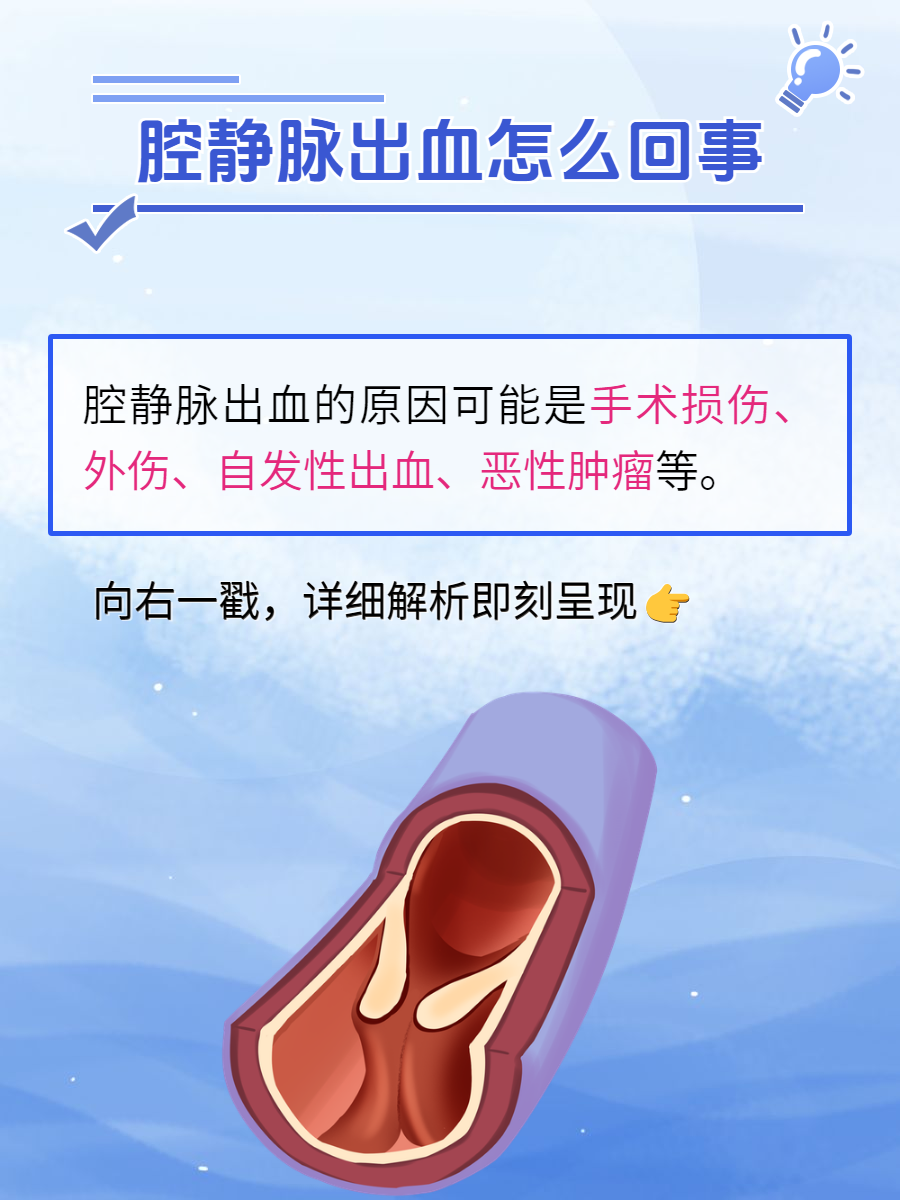 腔静脉出血怎么回事?