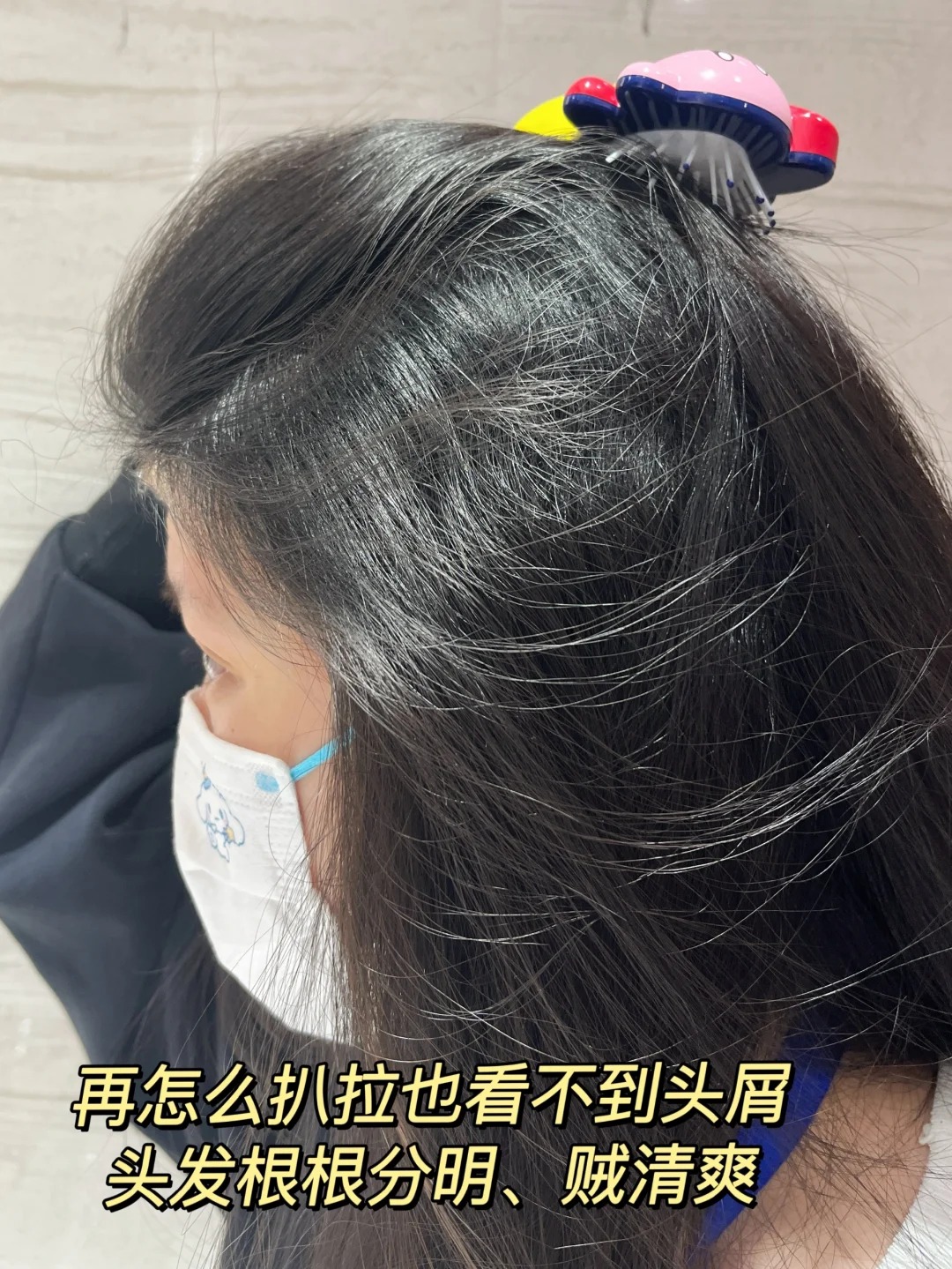 什么洗发水好用又能去屑止痒控油?