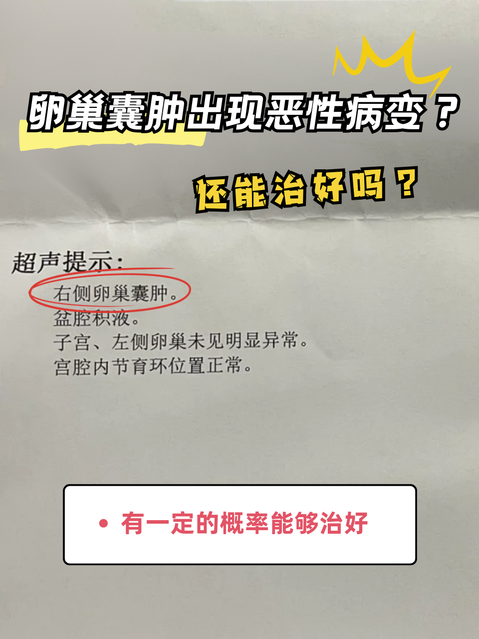 多卵巢发肿