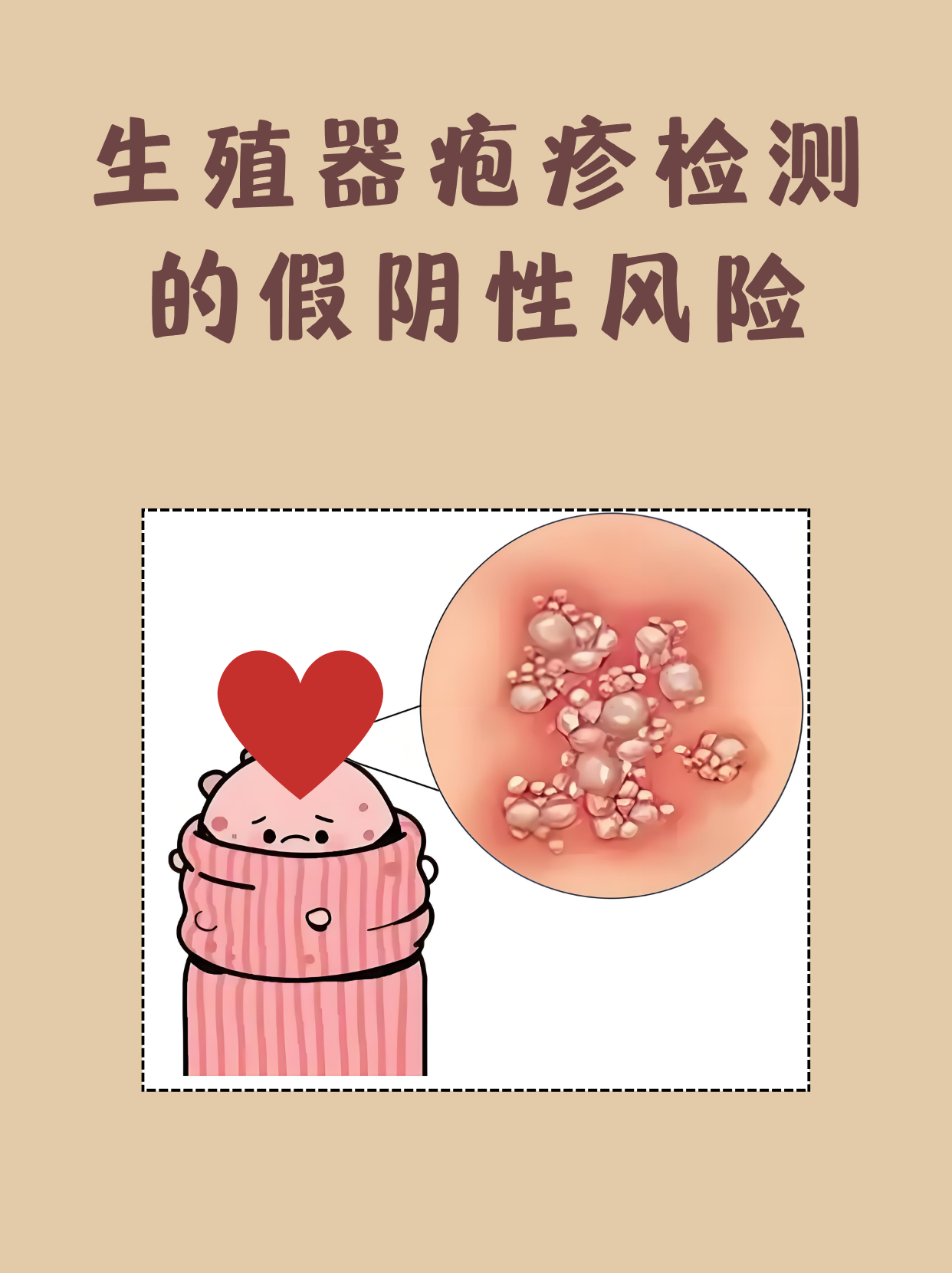 hsv病毒是什么意思二型(hsv2型病毒是怎么感染的)