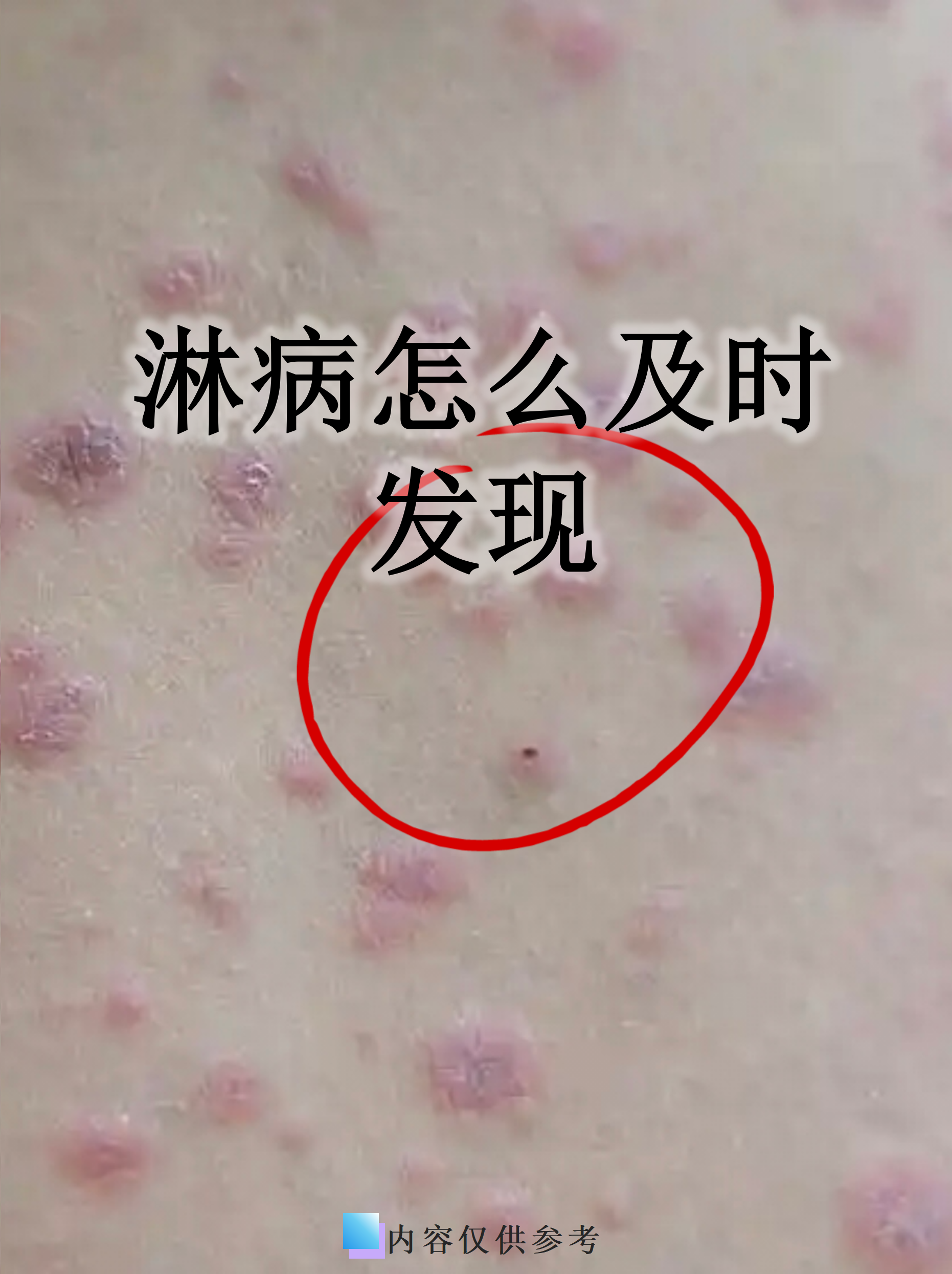  现在流行病的症状都有哪些(现在流行病的症状都有哪些呢)