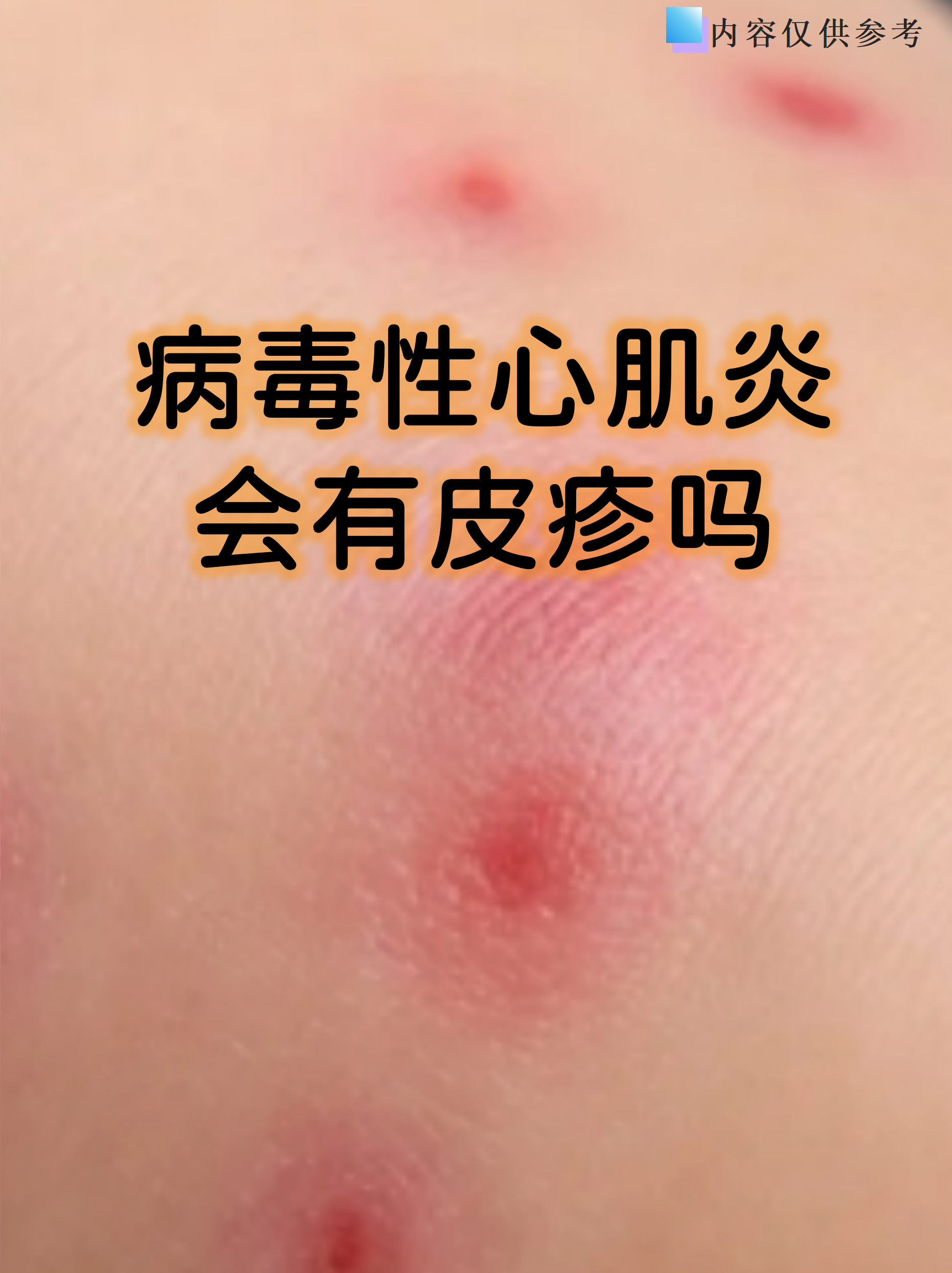 近几年出现的病毒有哪些症状(近期出现的病毒有什么症状表现)
