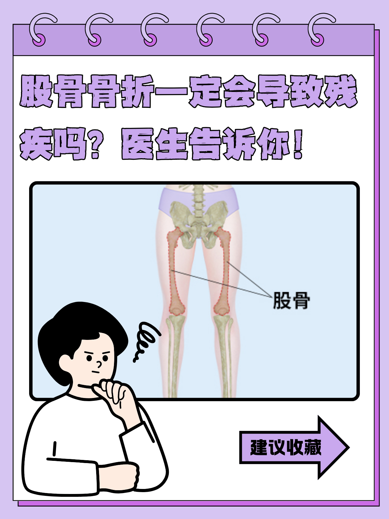 别慌,听听医生怎么说 股骨,也就是我们大腿部位的那根粗壮骨头,在身体