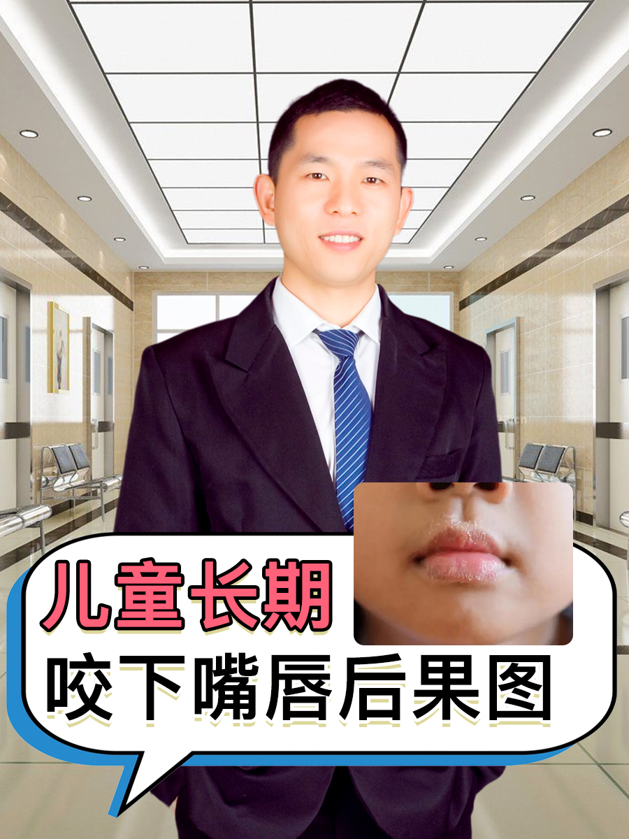 儿童长期咬下嘴唇后果图  在孩子的成长过程中,家长可能会发现孩子