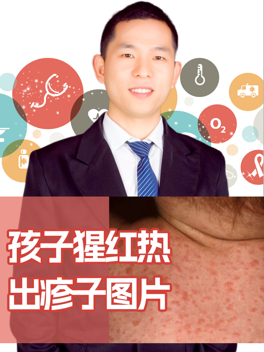孩子猩红热出疹子图片