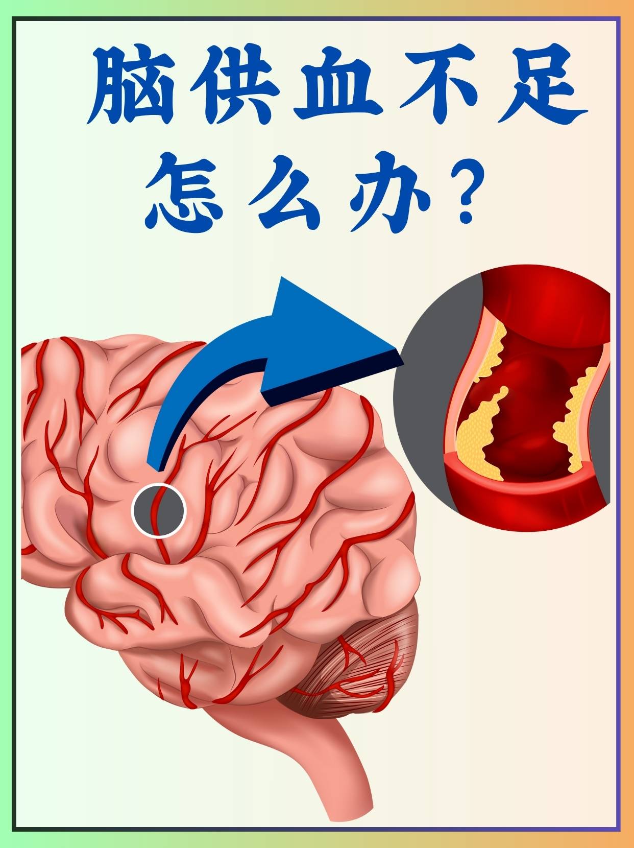 脑供血不足怎么办  大脑需要充足的气血滋养