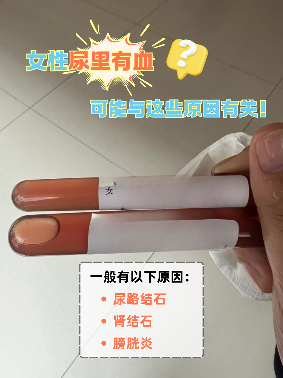 为什么小便会带血是不是喝水少了为什么在线 为什么小便会带血是不是喝水少了为什么在线