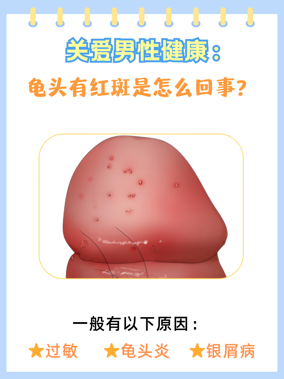 龟头作为男性重要的生殖器官,受到广大男性朋友的关注