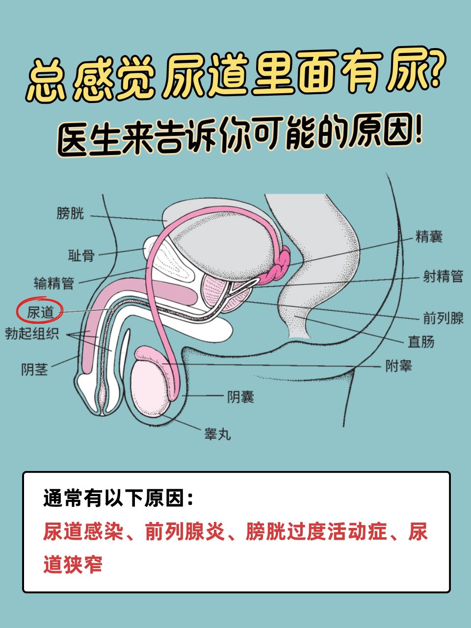 总感觉尿意就在尿道口,可能是喝水多了,也可能是有炎症