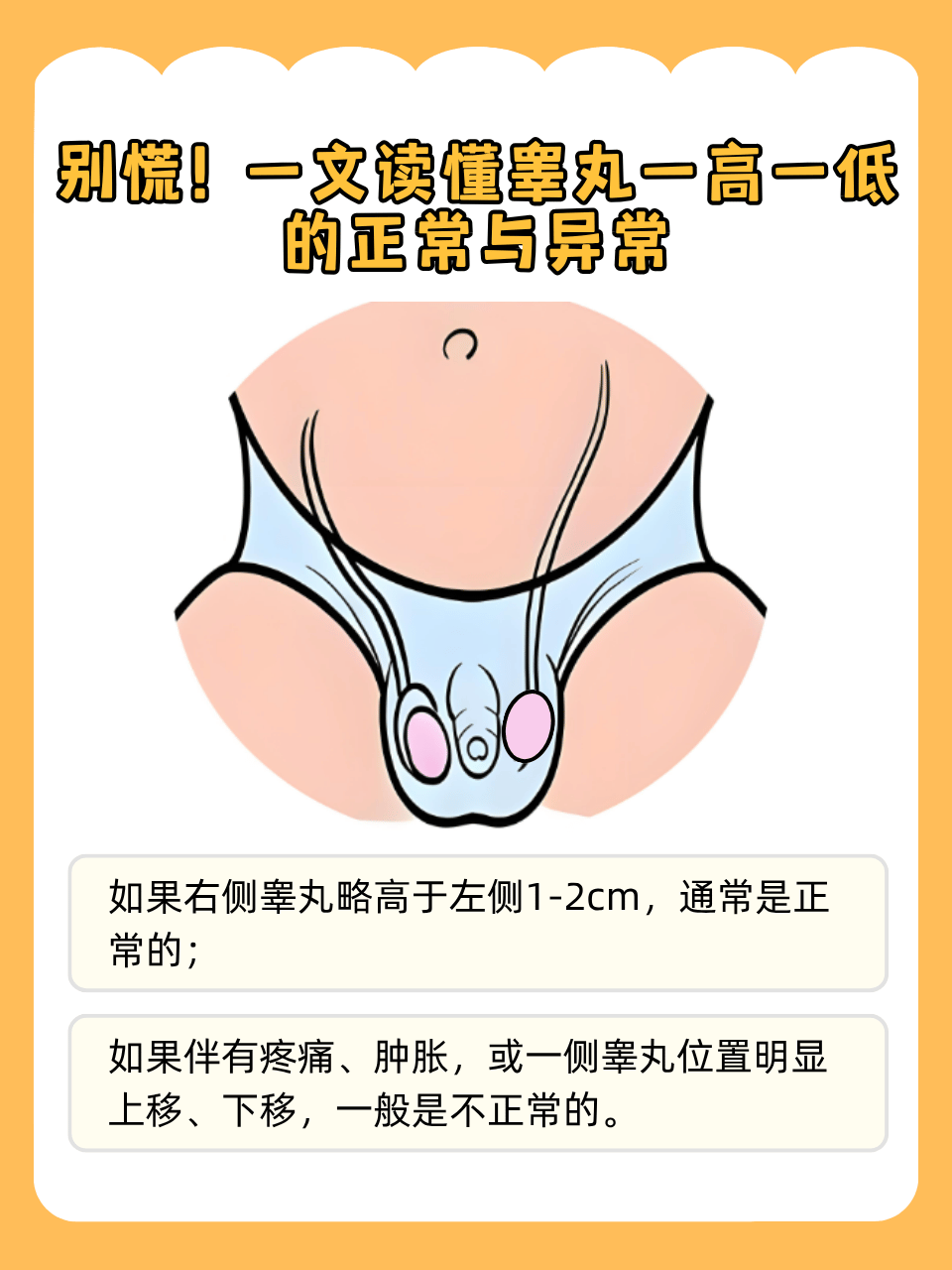 洗澡时偶然发现自己的睾丸一高一低,不少人心里会"咯噔"一下,担心是