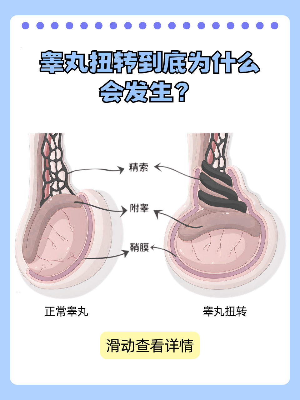 究竟是什么原因导致的,下面为你详细科普