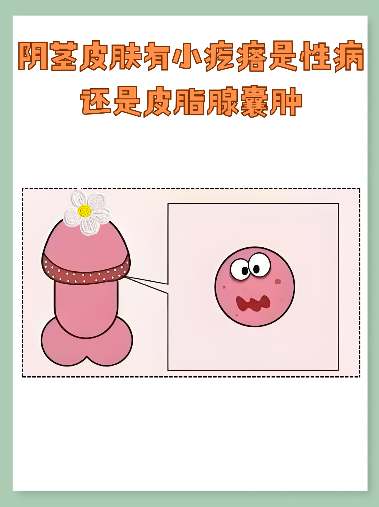 为什么会长皮脂腺囊肿,还长在脸上为什么在线