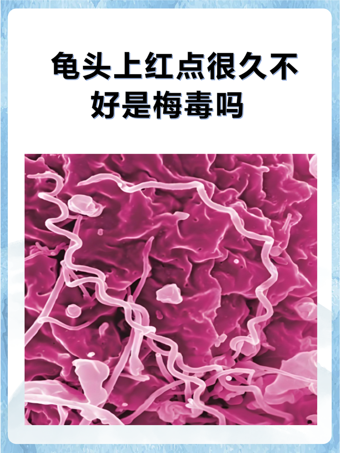 龟头上红点很久不好是梅毒吗