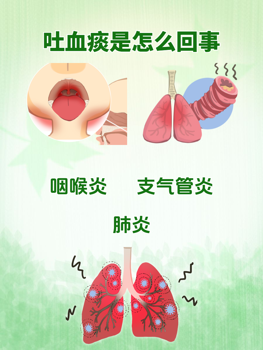 为什么咳嗽会有痰