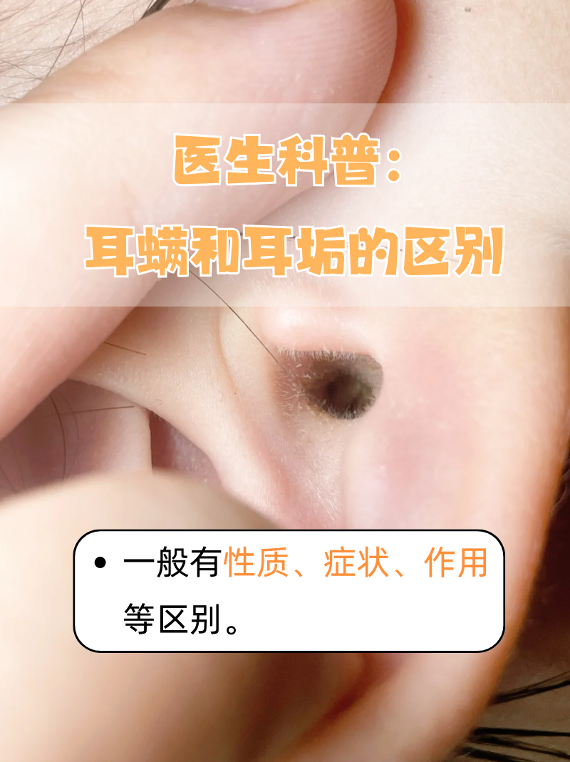 医生科普:耳螨和耳垢的区别