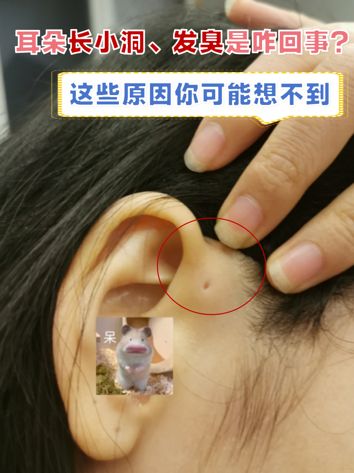 耳朵附近长小洞,一揉的时候感觉很臭,简直把手都染臭了