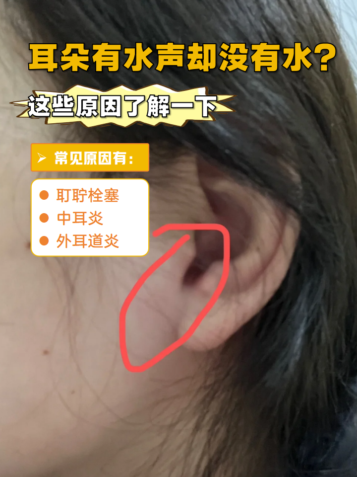 耳朵一扣就湿漉漉的为什么在线