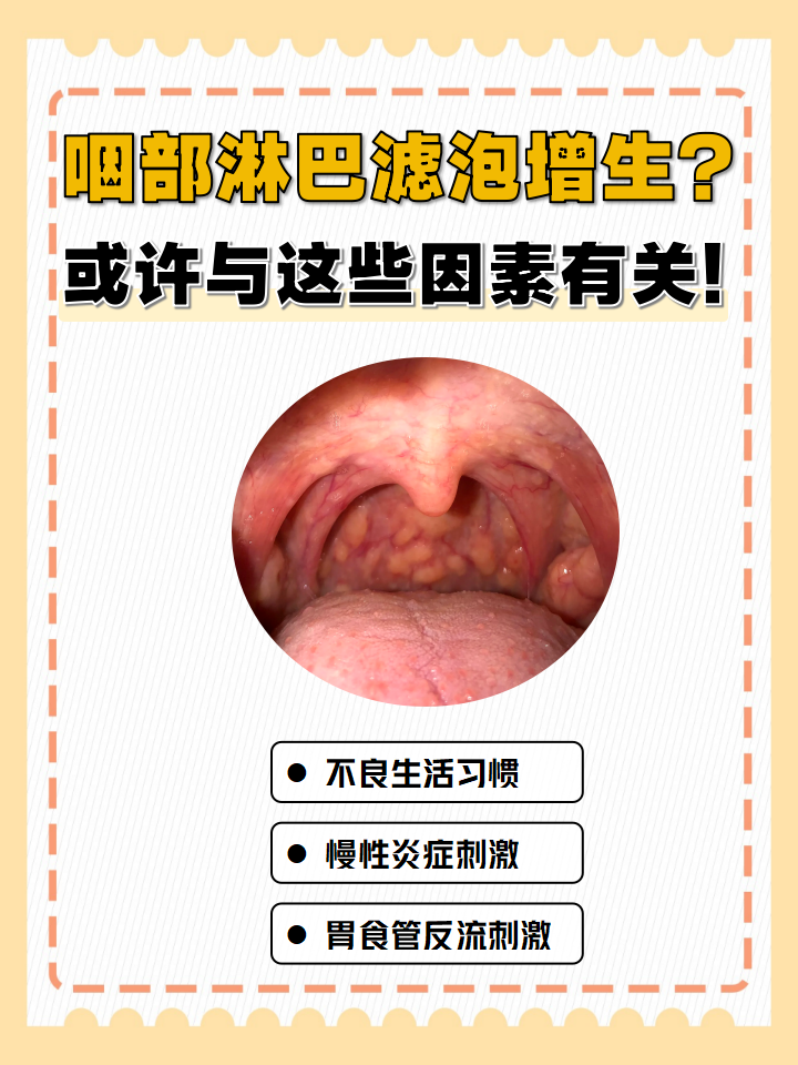 咽部淋巴滤泡增生?或许与这些因素有关!