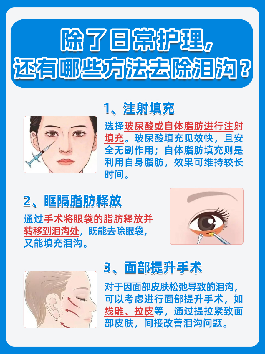 泪沟是指从内眼角开始,延伸至下眼睑靠近鼻侧的凹沟,通常由于眶隔下