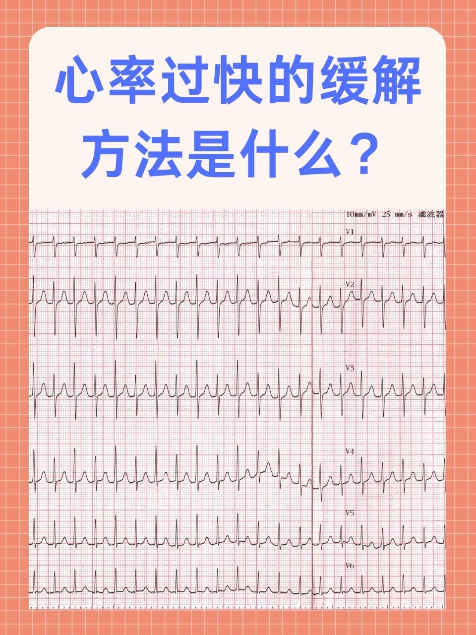 心脏时速图片