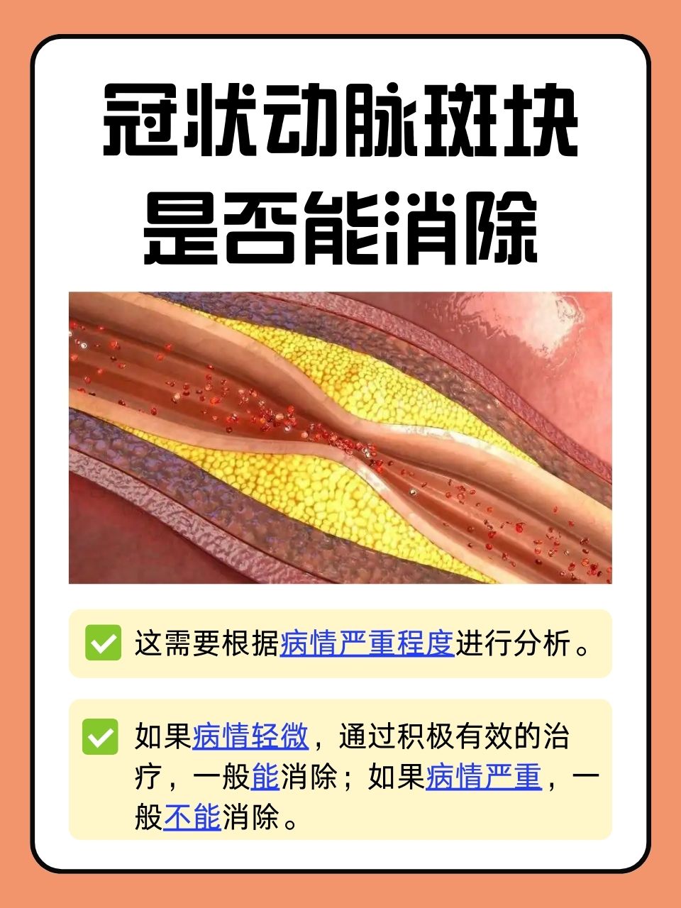 冠状动脉斑块,即冠状动脉粥样硬化斑块,是心血管健康领域